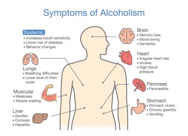 Alkolizm hasta belirtisi. Resimde hakkında sağlık sorunu olan kişilerin alkol bağımlılığı.