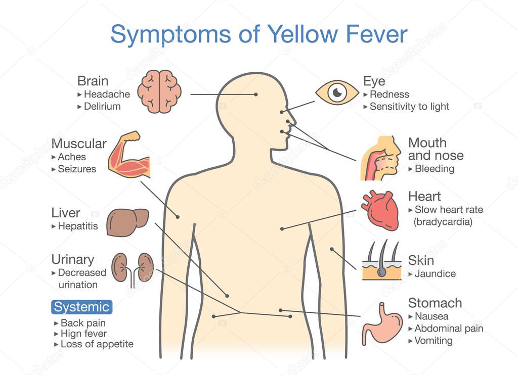 Diagram of Symptoms of Yellow fever patient. Illustration about disease diagnosis. 