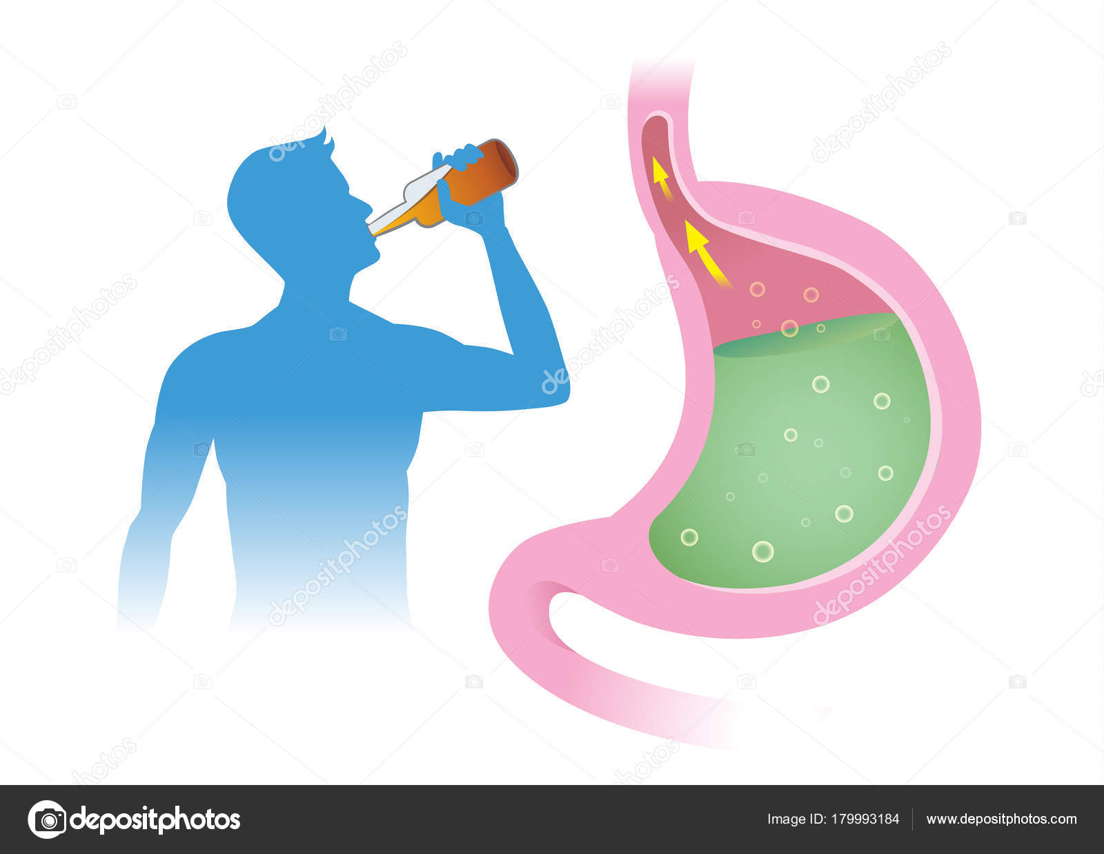 влияние алкоголя на желудок. желудочно кишечный тракт здорового человека и алкоголика. желудок пьющего человека.