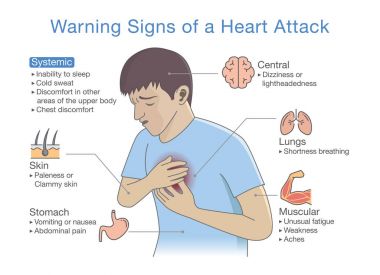 Diagram about warning signs of a heart attack. Illustration about disease symptoms when occurring. clipart