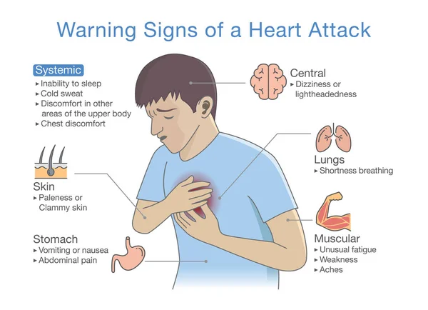 Diagram Warning Signs Heart Attack Illustration Disease Symptoms Occurring — Stock Vector