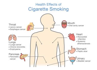 Diagram about health effect of cigarette smoking. Illustration about risk of smokers. clipart