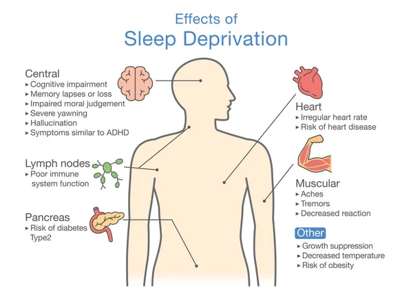 効果の睡眠不足の図 病気の診断についての図 — ストックベクタ