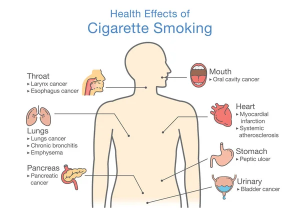 喫煙の健康影響について図します 喫煙の危険性についての図 — ストックベクタ