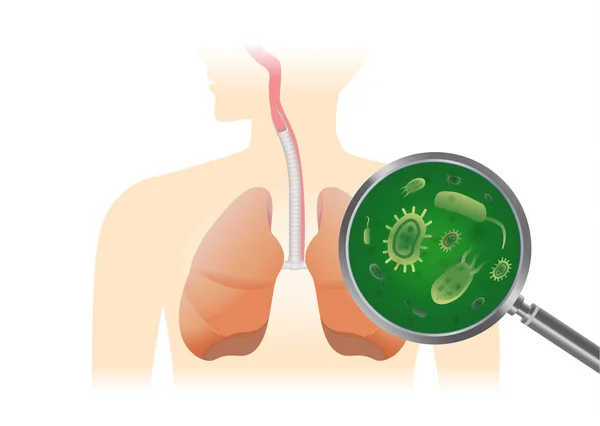 Viren Der Menschlichen Lunge Mit Einer Lupe Finden Medizinische Illustration — Stockvektor