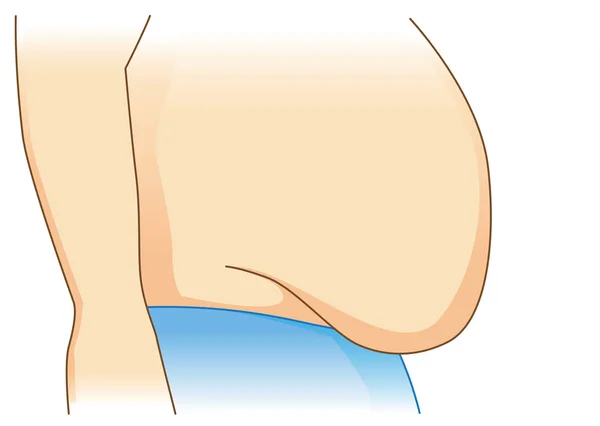 Ilustração Excesso Gordura Abdominal Vista Lateral Isolado —  Vetores de Stock