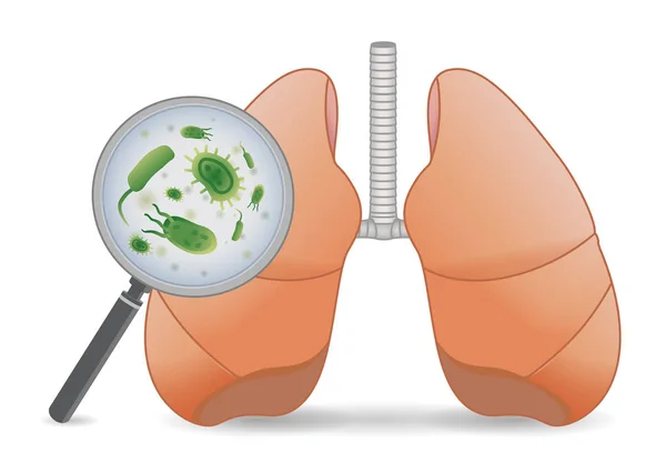 Att Hitta Virus Mänskliga Lungan Med Ett Förstoringsglas Medicinsk Illustration — Stock vektor