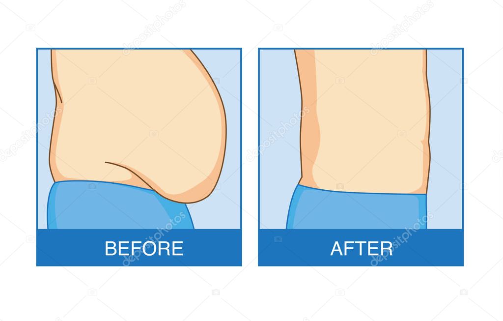 Before and after of excess abdominal fat to flat. Illustration about shape and lose weight.
