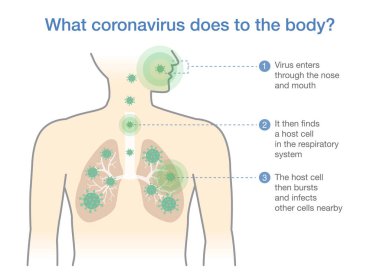 Coronavirus 'un vücuda ne yaptığını açıklayan tıbbi diyagram. Virüsün solunum sistemine girdiği Covid-19 hastalığı hakkında bir resim..