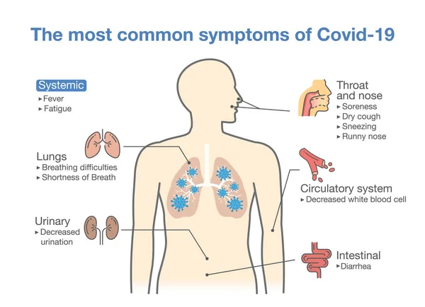 Meest Voorkomende Symptomen Van Covid 2019 Ziekte Van Het Coronavirus — Stockvector