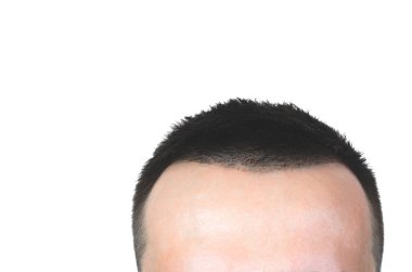 Temiz sağlıklı adamın saç fotoğrafını ekrana kapatın