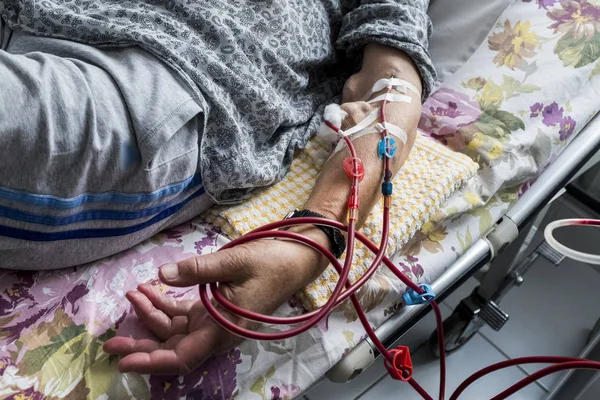 Kronik böbrek yetersizliği olgularında kan nakli