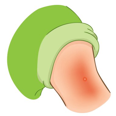 Reaksiyon enjeksiyon kol uygulandıktan sonra bir kişiyle Illustration. Diyabet, tedavi için de olmak skleroz veya aşı