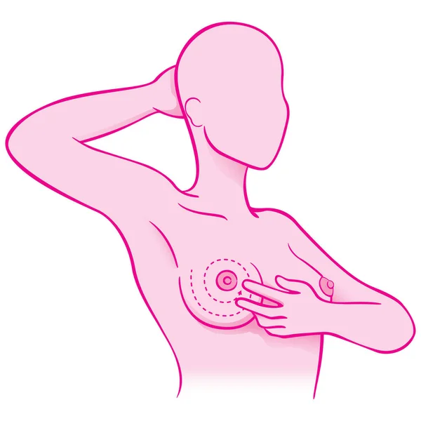 유방암, 예방 및 생활에 대 한 진단에 대 한 시험을 하 고 그녀의 가슴을만 지는 여자의 그림. 기관 및 교육 자료에 적합 — 스톡 벡터