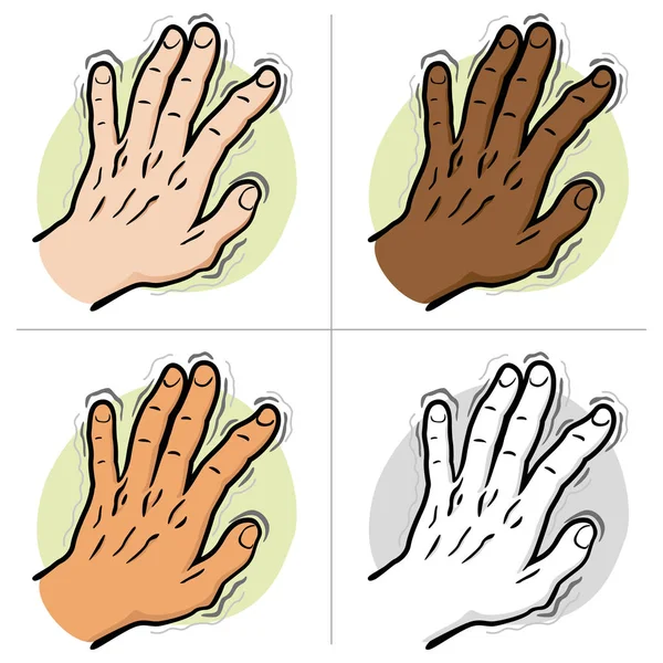 Close body part, pair of hands shaking symptoms of, Parkinson's disease, cold or fear, ethnic. Ideal for educational and institutional and medical materials — Stock Vector