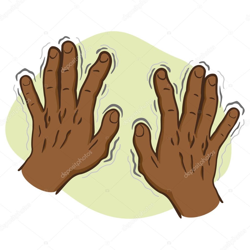 Close body part, pair of hands shaking symptoms of, Parkinson's disease, cold or fear, afrodescendent. Ideal for educational and institutional and medical materials