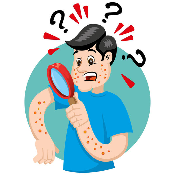 Mascot bob man person, with allergy, rashes and dermatitis, symptom. Ideal for informational and institutional related to medicine