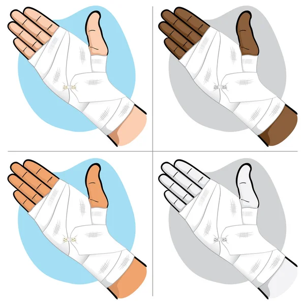 Erste-Hilfe-Hände mit Verband im Hand- und Handgelenksbereich, ethnische Zugehörigkeiten. ideal für medizinische, informative und institutionelle Kataloge — Stockvektor