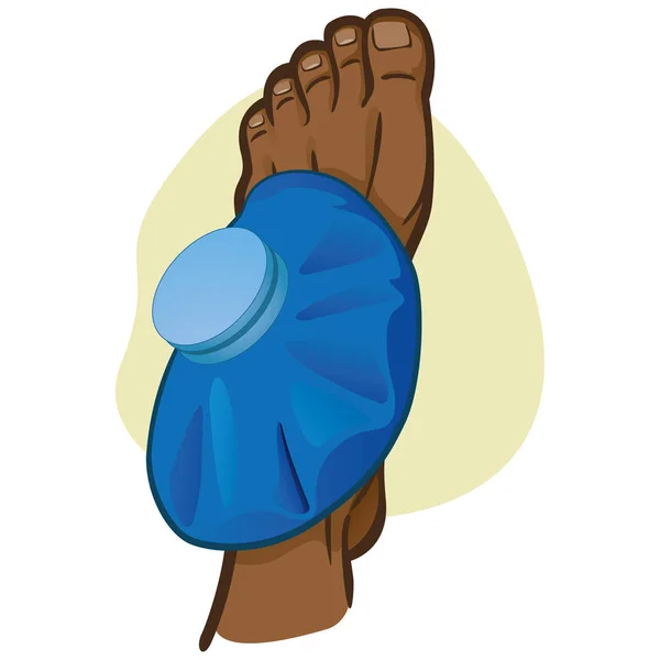 Illustration of firs aid person afro descent, foot with thermal bag, top view. Ideal for catalogs, information and medicine guides — Stock Vector