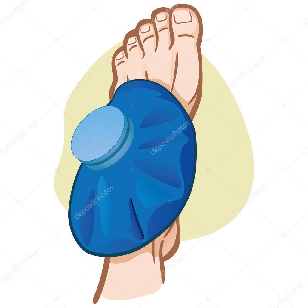 Illustration of firs aid person caucasian, foot with thermal bag, top view. Ideal for catalogs, information and medicine guides
