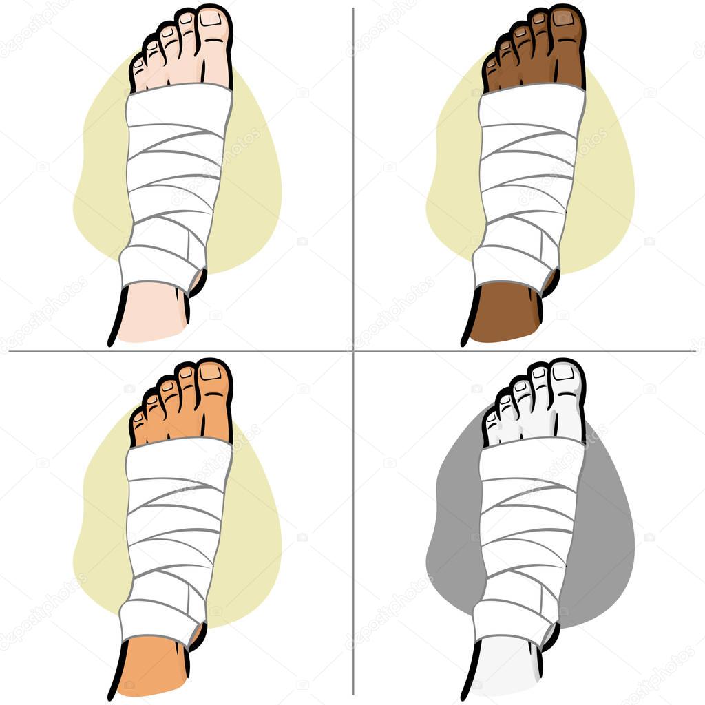Illustration of firs aid person ethnicity, bandaged foot, top view. Ideal for catalogs, information and medicine guides