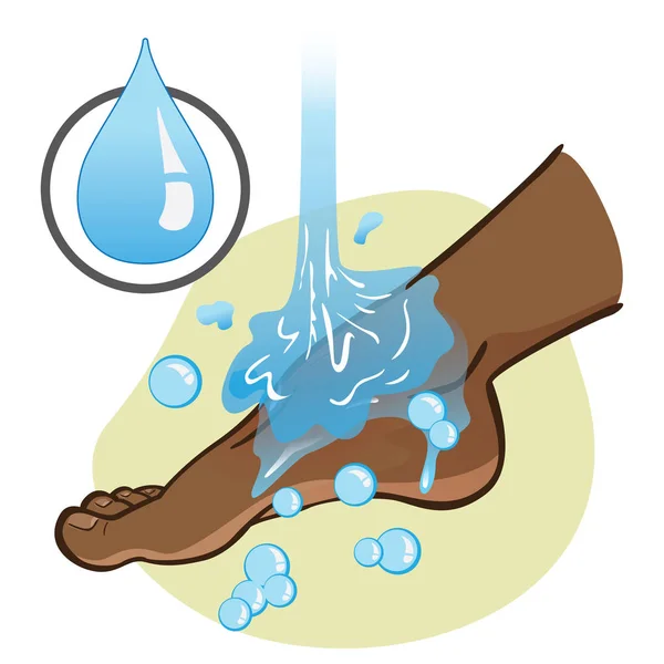 Illustratie van EHBO persoon, afro afdaling, voet zijkant, spoelen of wassen met water, voet met een blessure. Ideaal voor catalogi, informatie en geneeskunde gidsen — Stockvector