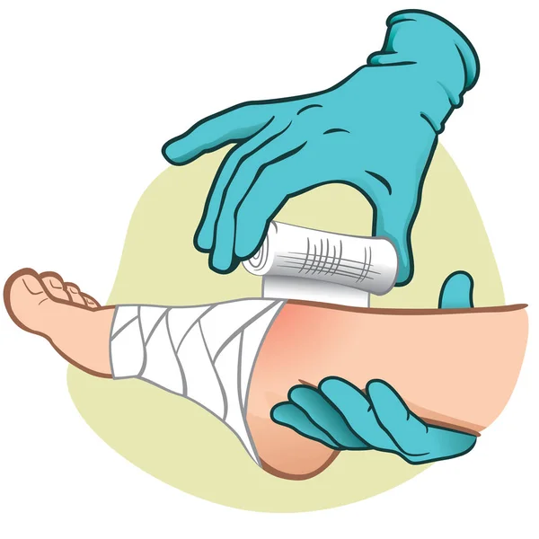 Ilustración de la persona de primeros auxilios, caucásica, vista lateral del pie, manos con guantes vendando el pie. Ideal para catálogos, guías de información y medicina — Vector de stock