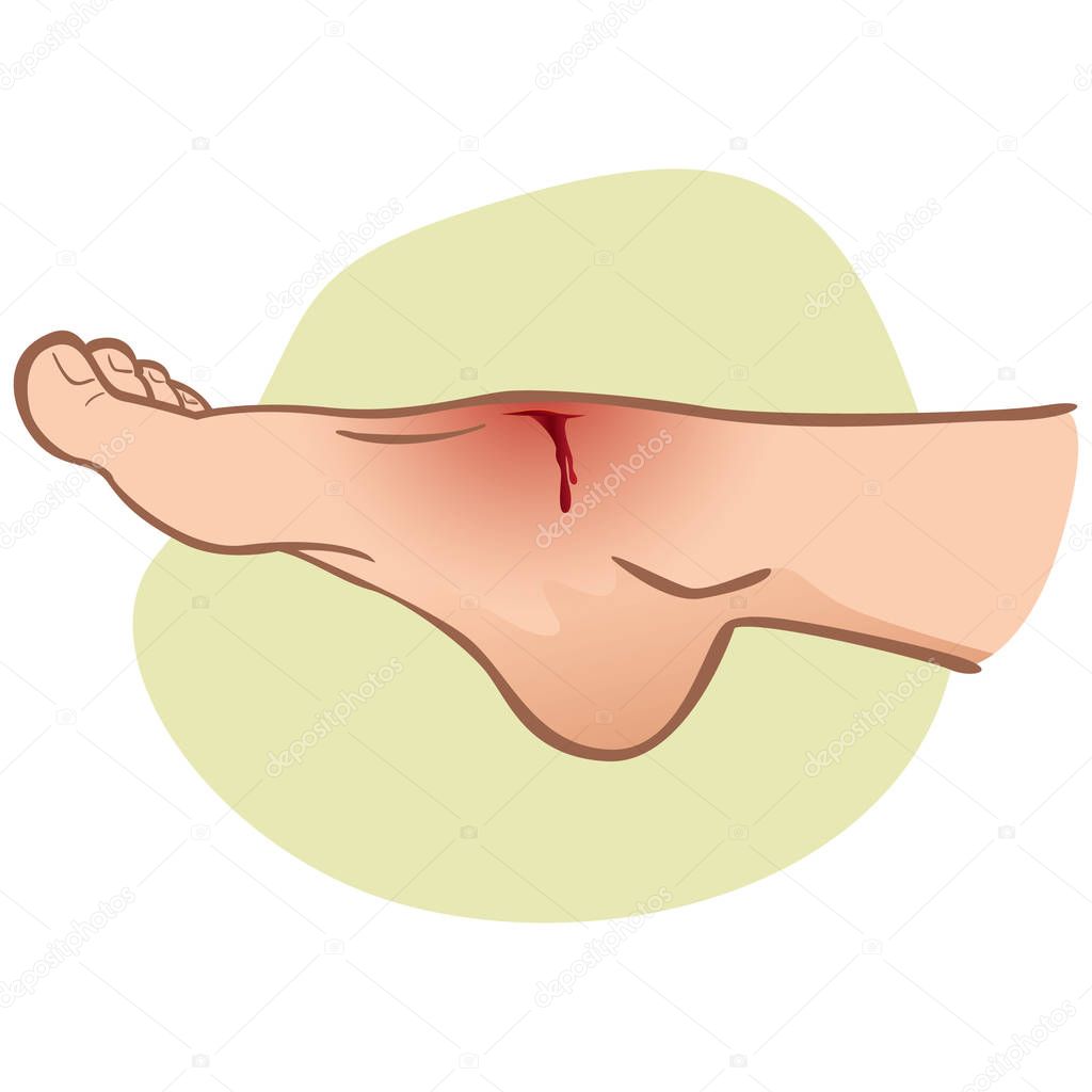 Illustration First Aid person, caucasian, standing side view, with a