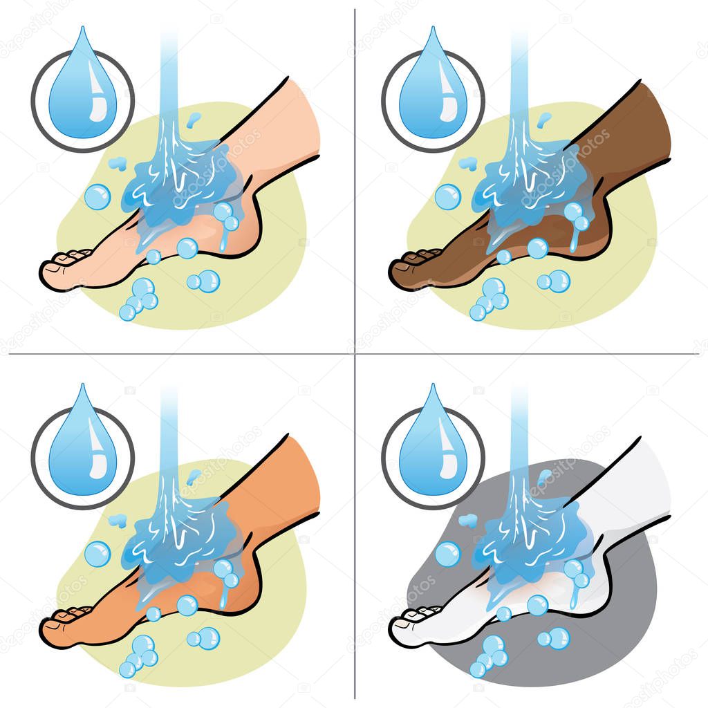 Illustration of first aid person, ethnic, foot side view, rinsing or washing with water, foot with an injury. Ideal for catalogs, information and medicine guides