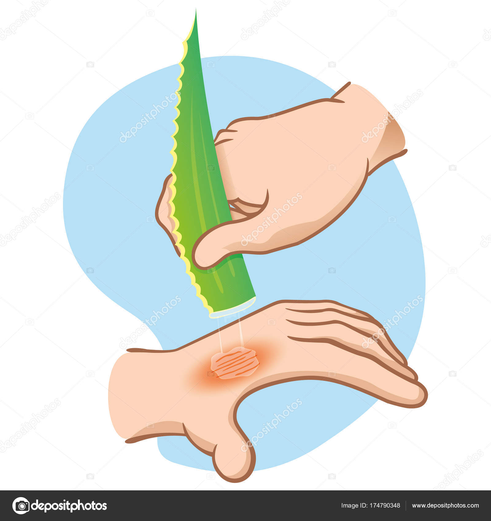 burn injury clipart