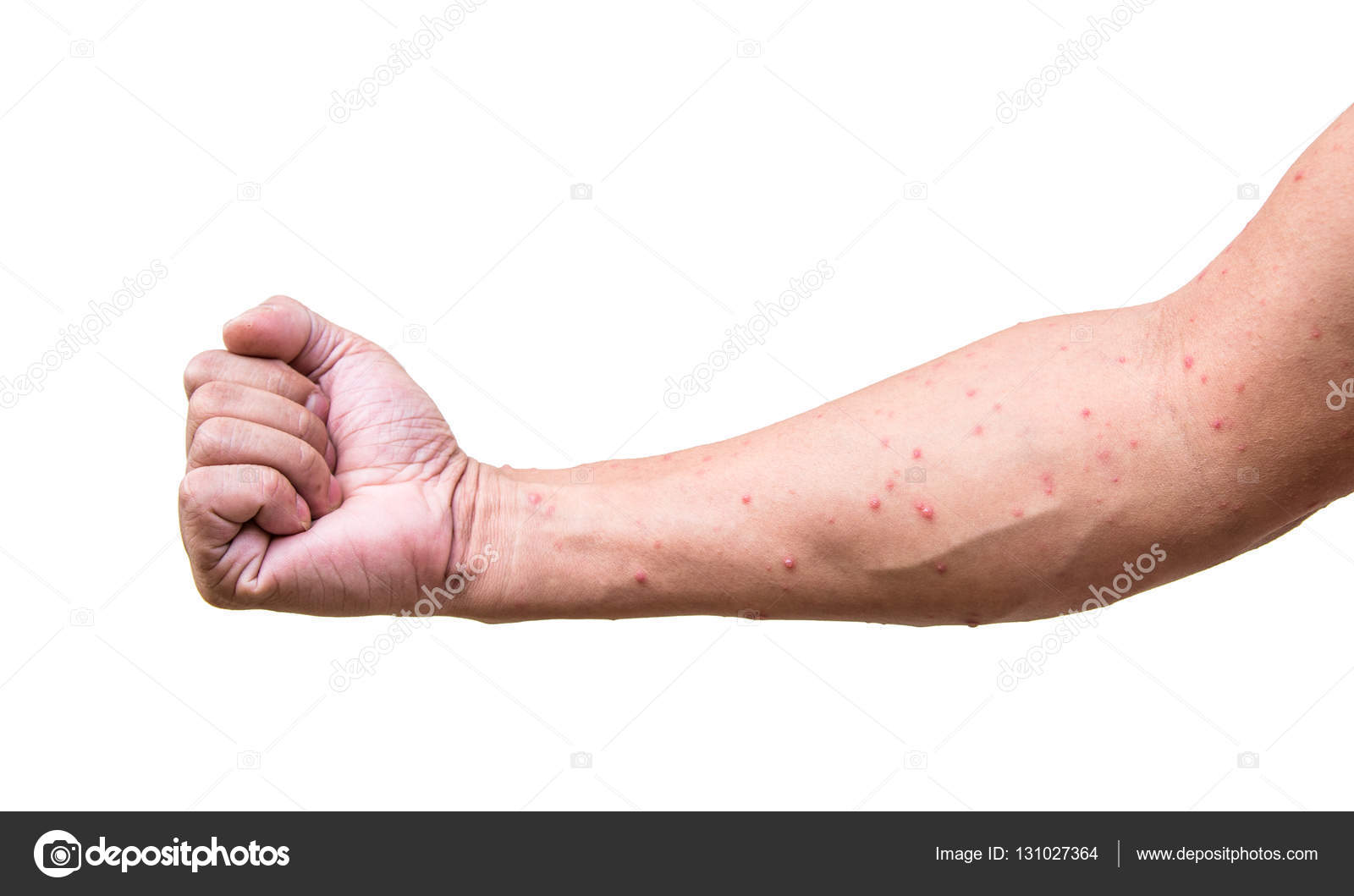 Doenças Definidoras de SIDA | Concise Medical Knowledge, image size:1600x1059