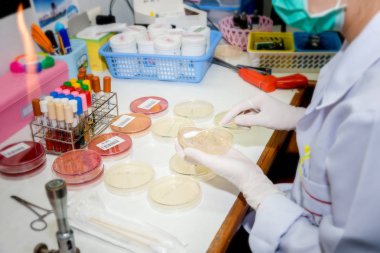 Tıbbi teknoloji uzmanı çizgi plaka bakteri kültürü veya ident için