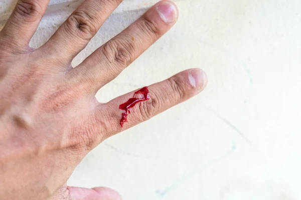 Настоящая кровь на пальце после аварии с ножом — стоковое фото
