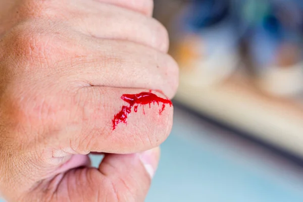 Настоящая кровь на пальце после аварии с ножом — стоковое фото