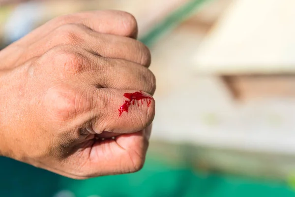 Pravá krev na prstu po nehodě nůž — Stock fotografie