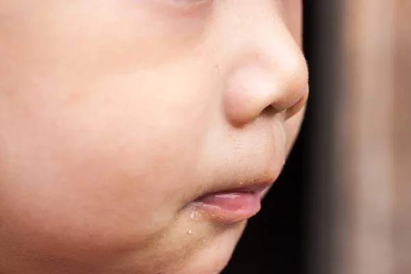 Hastalık Asya bebek çocuk yüz — Stok fotoğraf