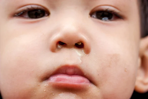 Nemoc asijské baby boy tvář Stock Snímky