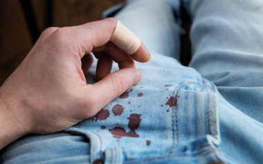 kaza kumaş üzerine