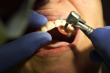 diş hekimi hastalar diş diş Kliniği, parlak bir ışık altında diş hekimleri sandalyede incelenmesi