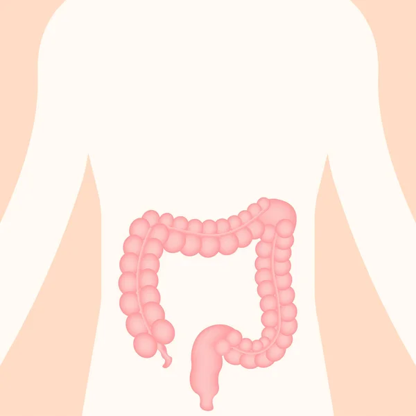 Colitis für medizinische Zwecke. Gastroenterologie. Darm-Verstopfung. Gesundheitsversorgung. Vektoraktiendarstellung. — Stockvektor