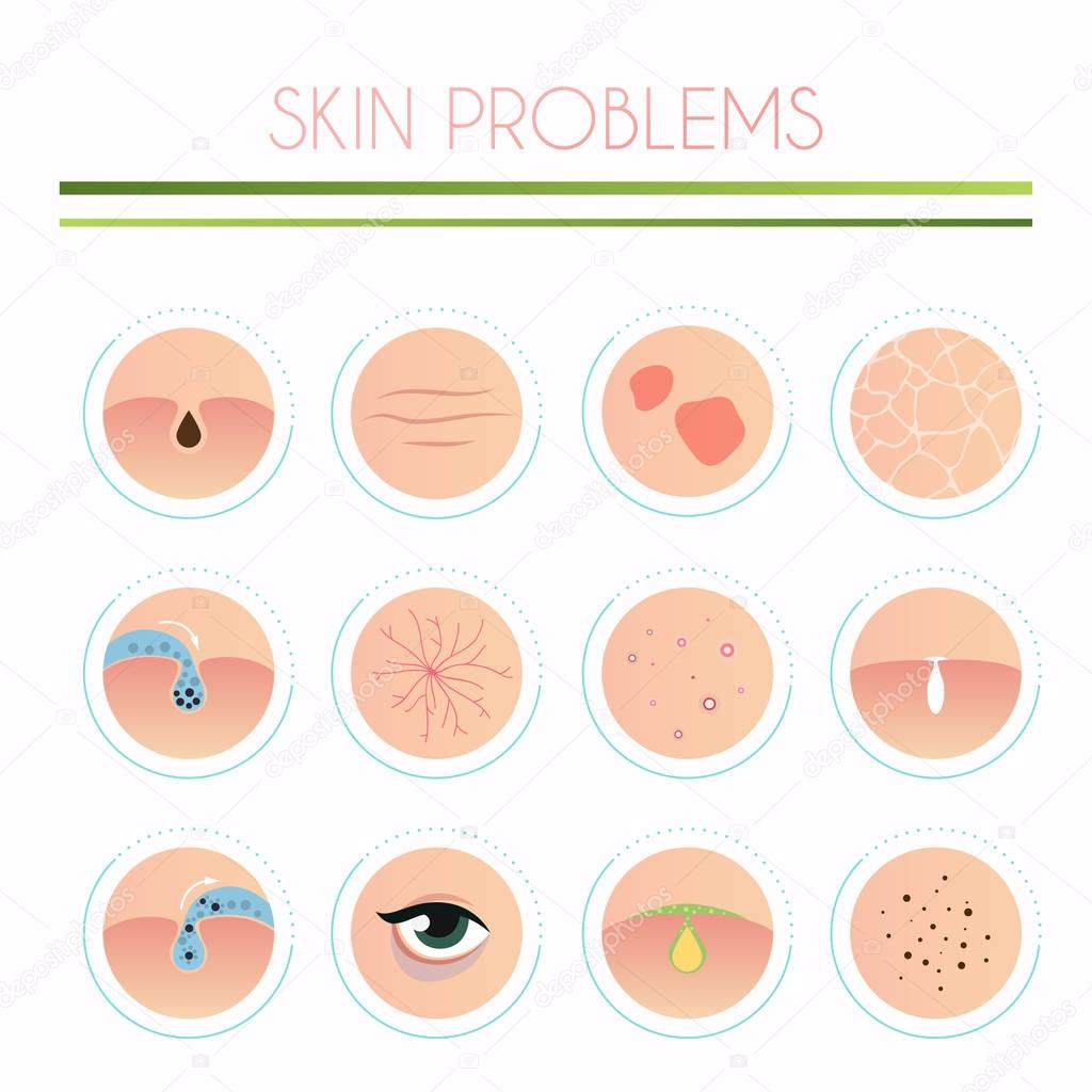 Skin problems solution, home remedies