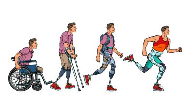 Rehabilitasyon evrimi. Erkek bacak protezi
