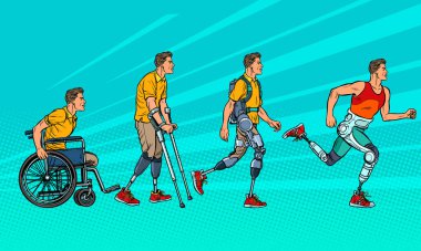 Rehabilitasyon evrimi. Erkek bacak protezi