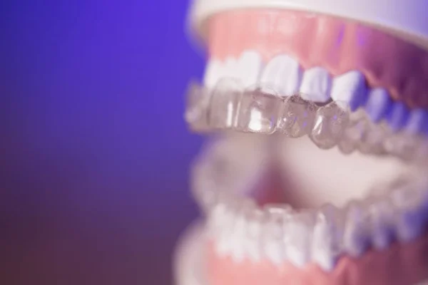 Denture with transparent orthodontics — Stock Photo, Image