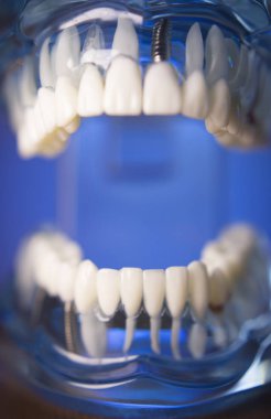 Takma diş diş hekimliği öğrencileri için