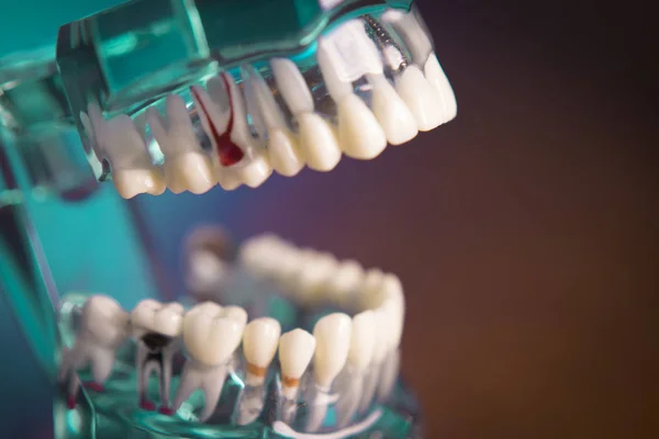 Prótesis dental para estudiantes de odontología — Foto de Stock