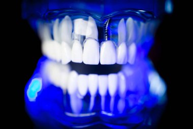 Takma diş diş hekimliği öğrencileri için