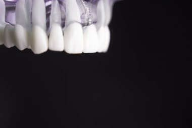 Takma diş diş hekimliği öğrencileri için