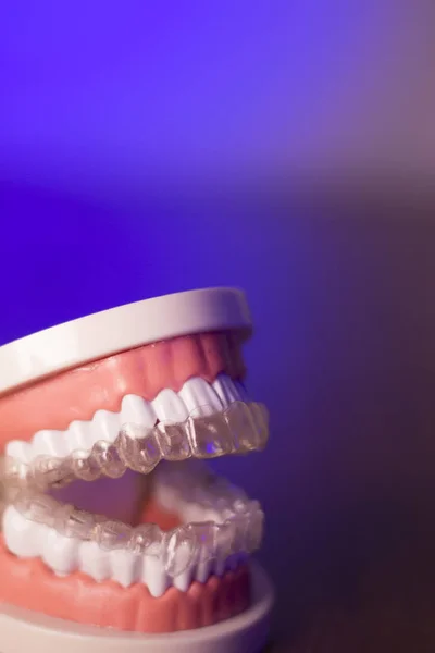 Стоматологія з прозорою ортодонтією — стокове фото