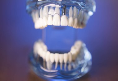 Takma diş diş hekimliği öğrencileri için